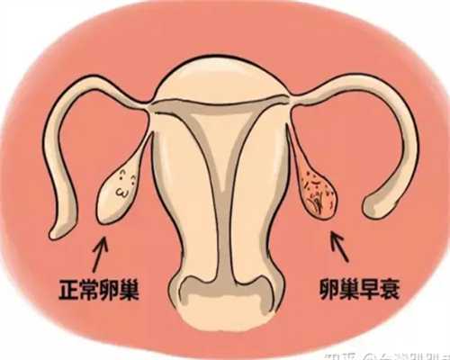 输卵管堵塞：如何从源头预防，降低患病风险