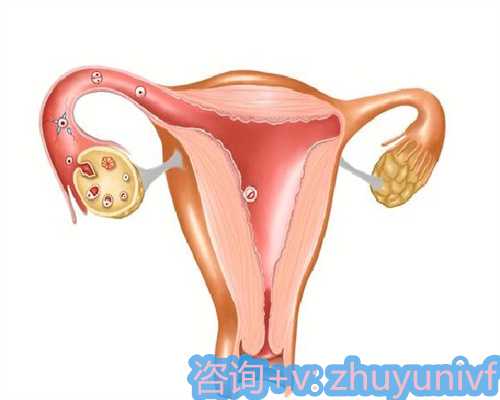 寻找天津代孕妈网站,做试管婴儿要多少钱