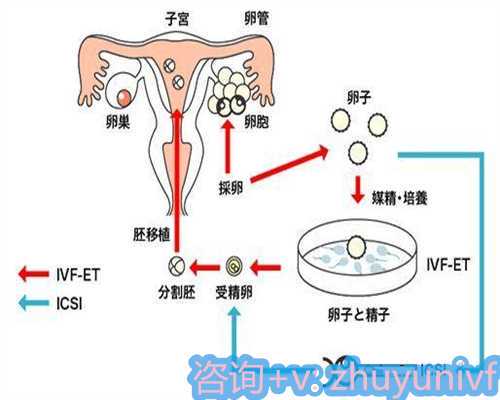天津供卵价格做第一代试管婴儿的费用是多少(一代试管与二代试管的费用)